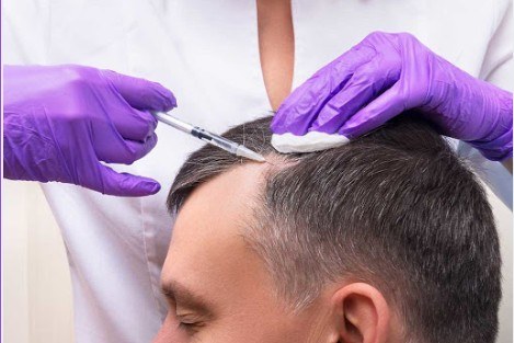 ExoGro exosome scalp treatment ExoGro exosome scalp treatment