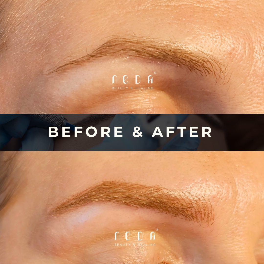 Microblading before and after