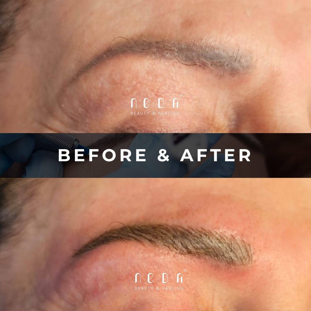 Microblading before and after