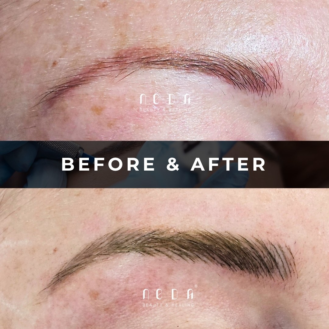 Microblading before and after