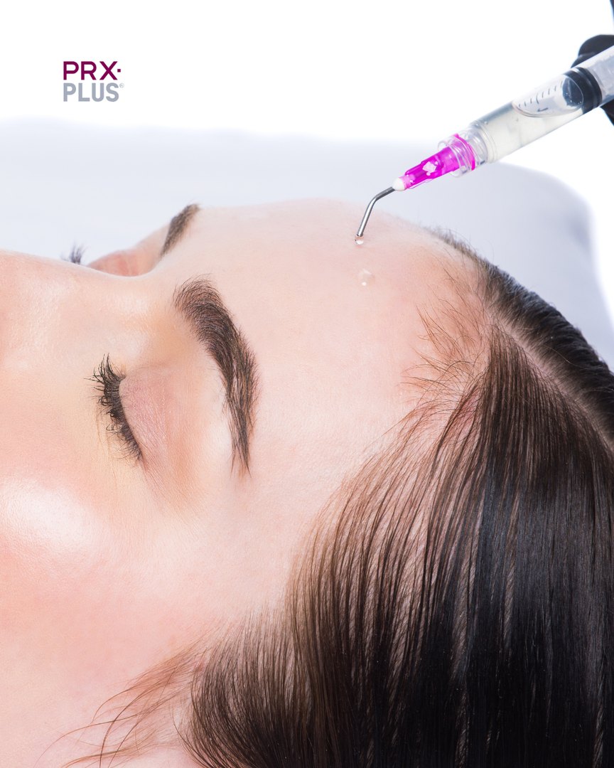 PRX Plus treatment PRX Plus being applied during a treatment